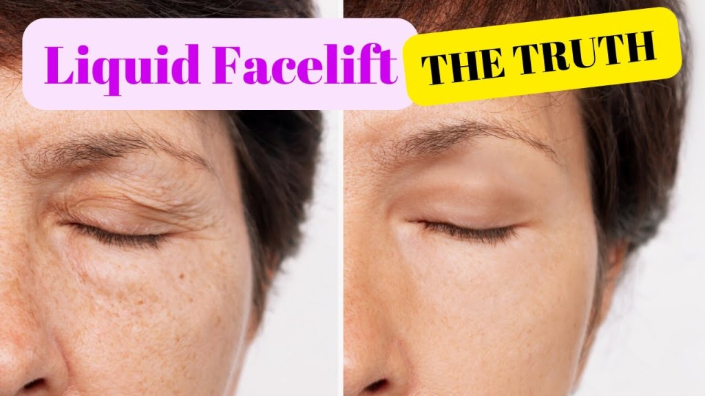 Picture of: What is a Liquid Facelift? Will it Work For You?  Dr